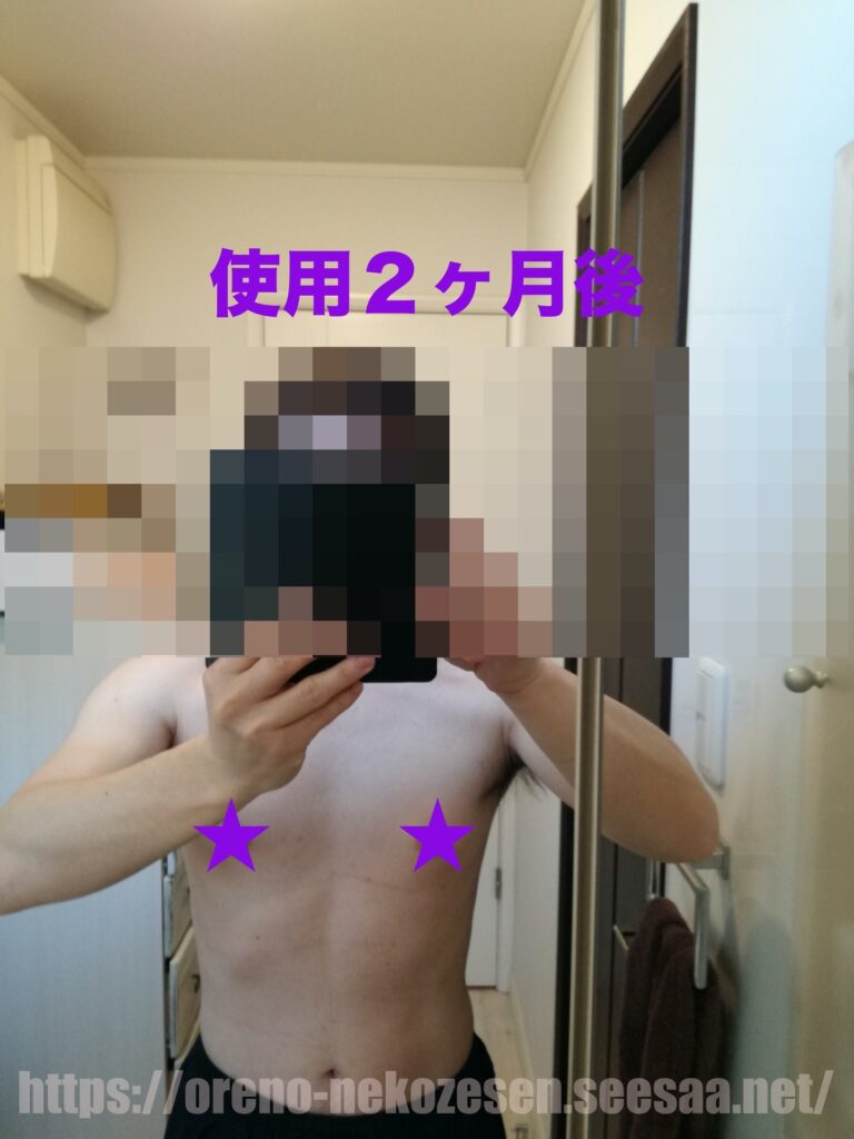 妊娠線クリーム使用2ヶ月後の猫背線の写真