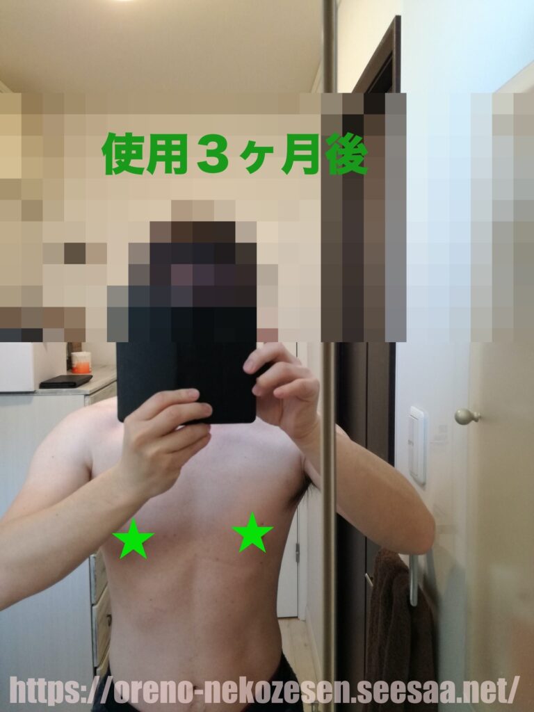 妊娠線クリーム使用3ヶ月後の猫背線の写真