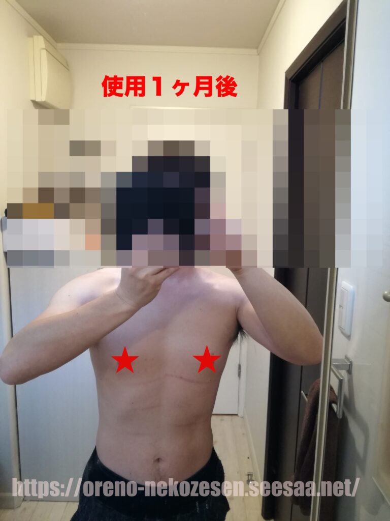 妊娠線クリーム使用1ヶ月後の猫背線の写真