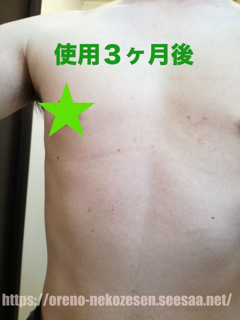 ノコア使用1ヶ月目の写真アップ